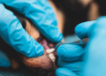 An expert talks: the best the best dental care for dog